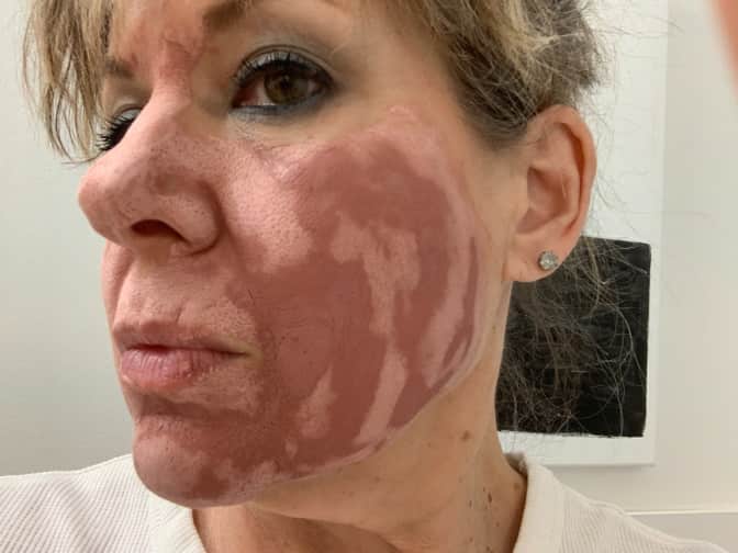 Photo of woman wearing clay face mask