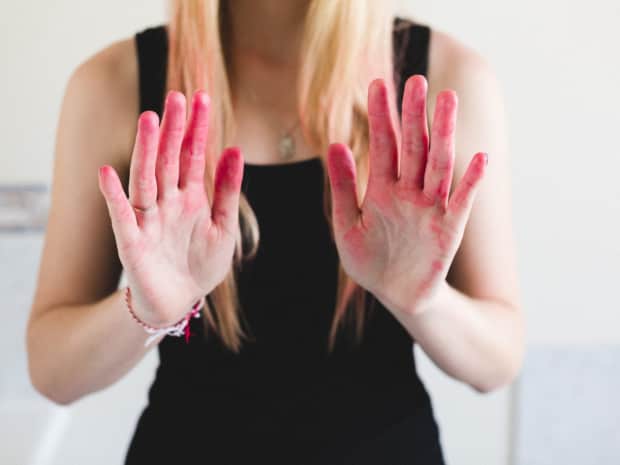 Image of person with red dye on palms of hands